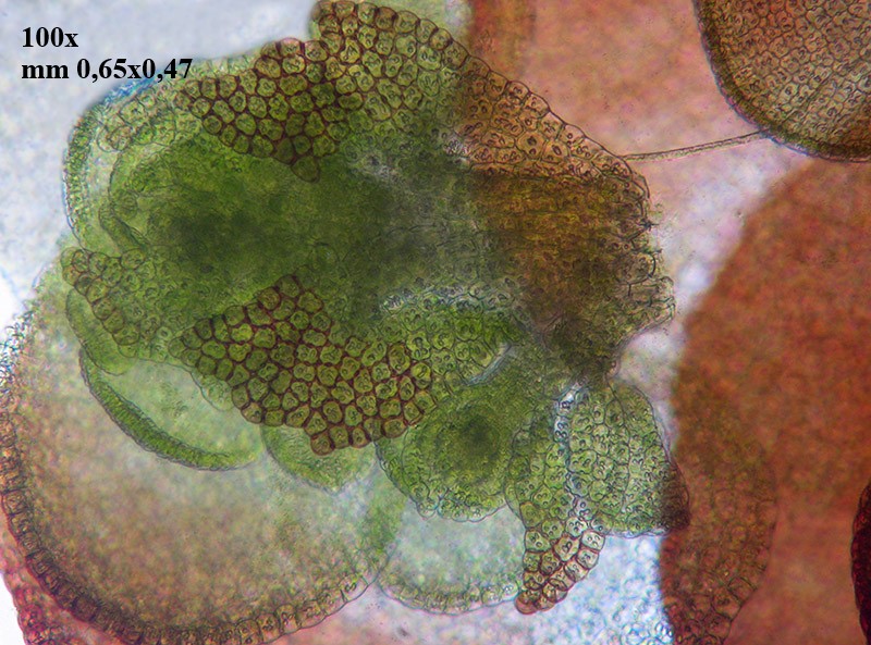 Calypogeia muelleriana?